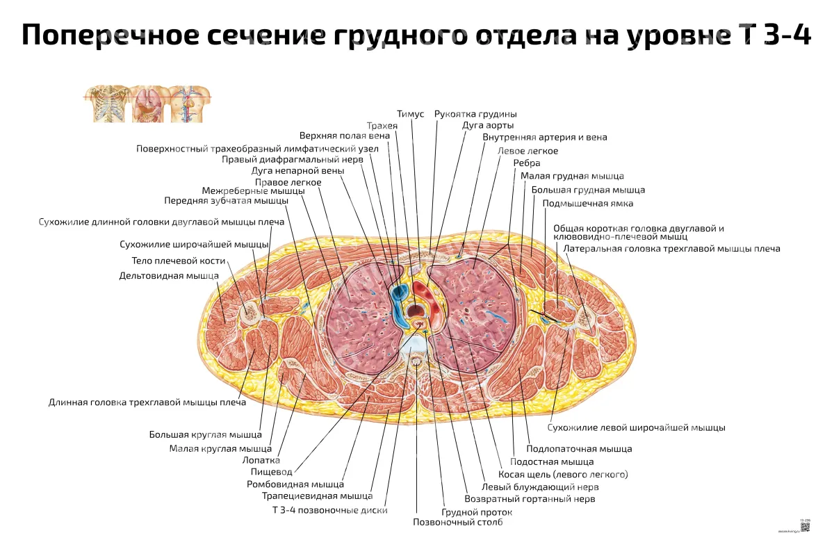 Поперечное сечение грудного отдела на уровне Т 3-4 — медицинский плакат