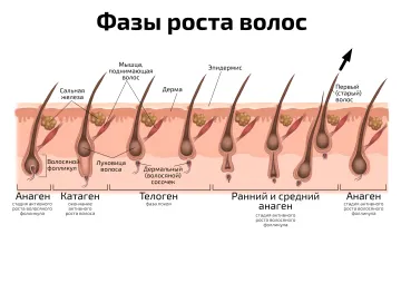 Фазы роста волос — медицинский плакат