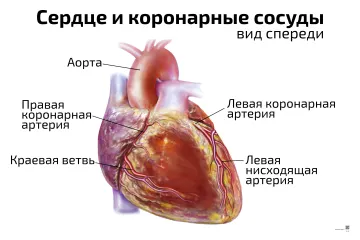 Сердце и коронарные сосуды — медицинский плакат