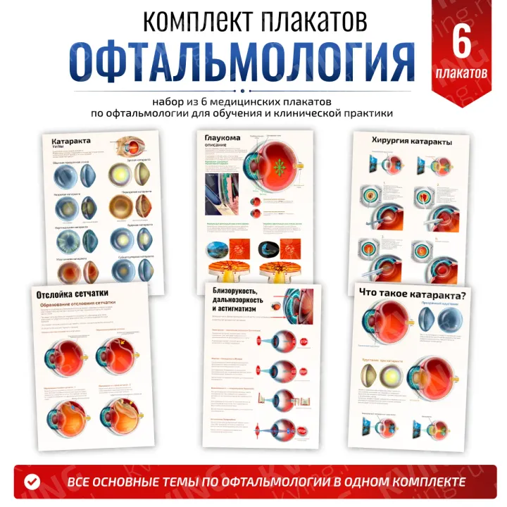 Комплект плакатов для кабинета офтальмолога
